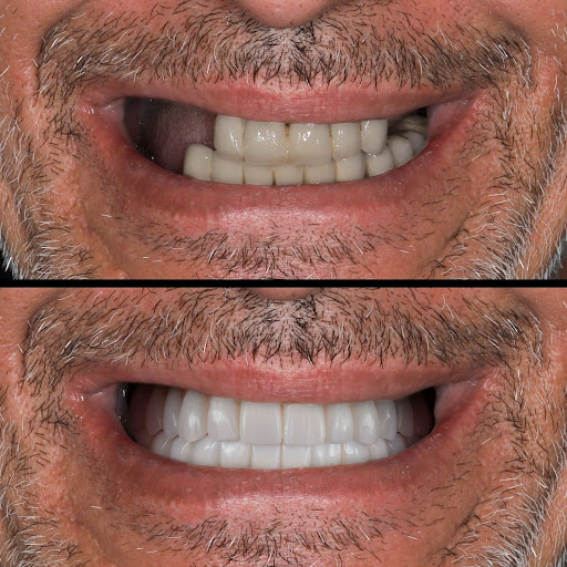Cosmetic Dentistry Options to Transform Your Smile